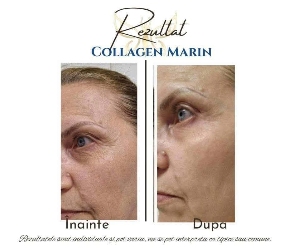 COLLAGEN MARIN